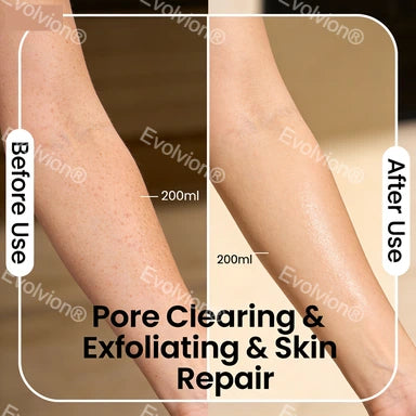 Evolvion®Peel Shot Kojic Acid & Turmeric Spray 200ml - Pore Clearing, Exfoliating & Skin Repair